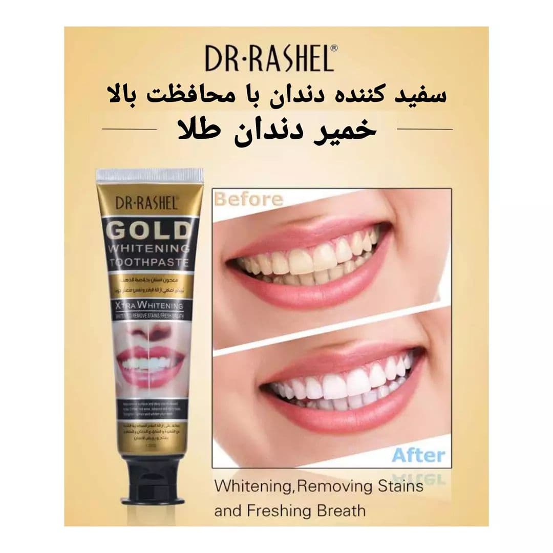 خمیر دندان طلا دکتر راشل سفیدکننده 120گرم DR.RASHEL Gold Toothpaste